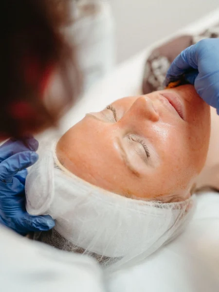 Glo Med Aesthetics | Chemical-Peel | Nevada City, CA